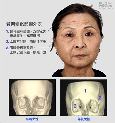 額頭有凹洞|額頭突然凹陷是什麼原因？排除外傷後的因素要慎重